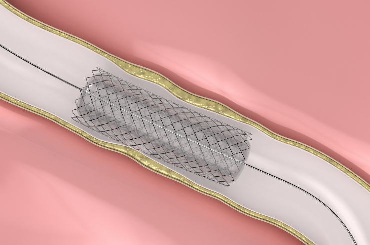Heartlink Cardiac Centre