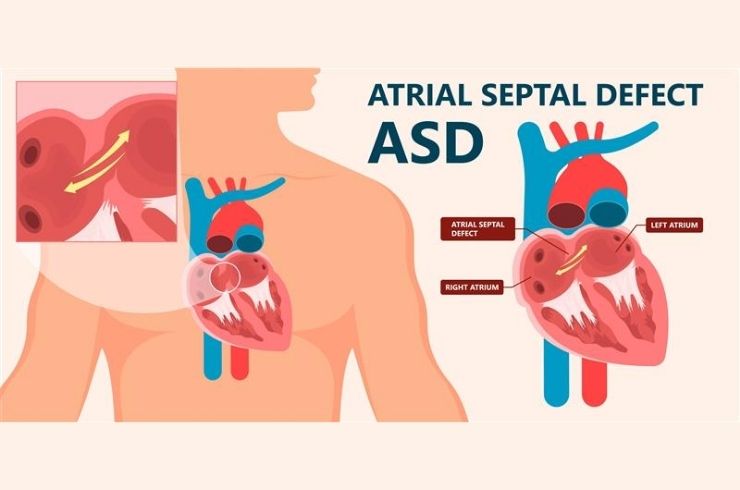 Heartlink Cardiac Centre