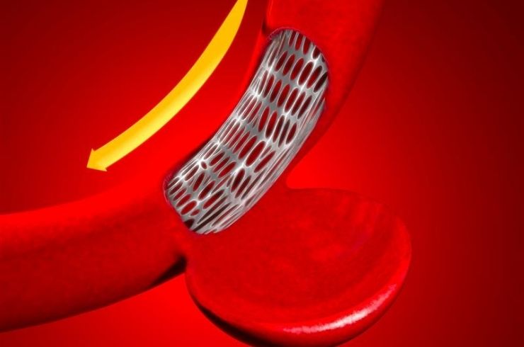 Heartlink Cardiac Centre